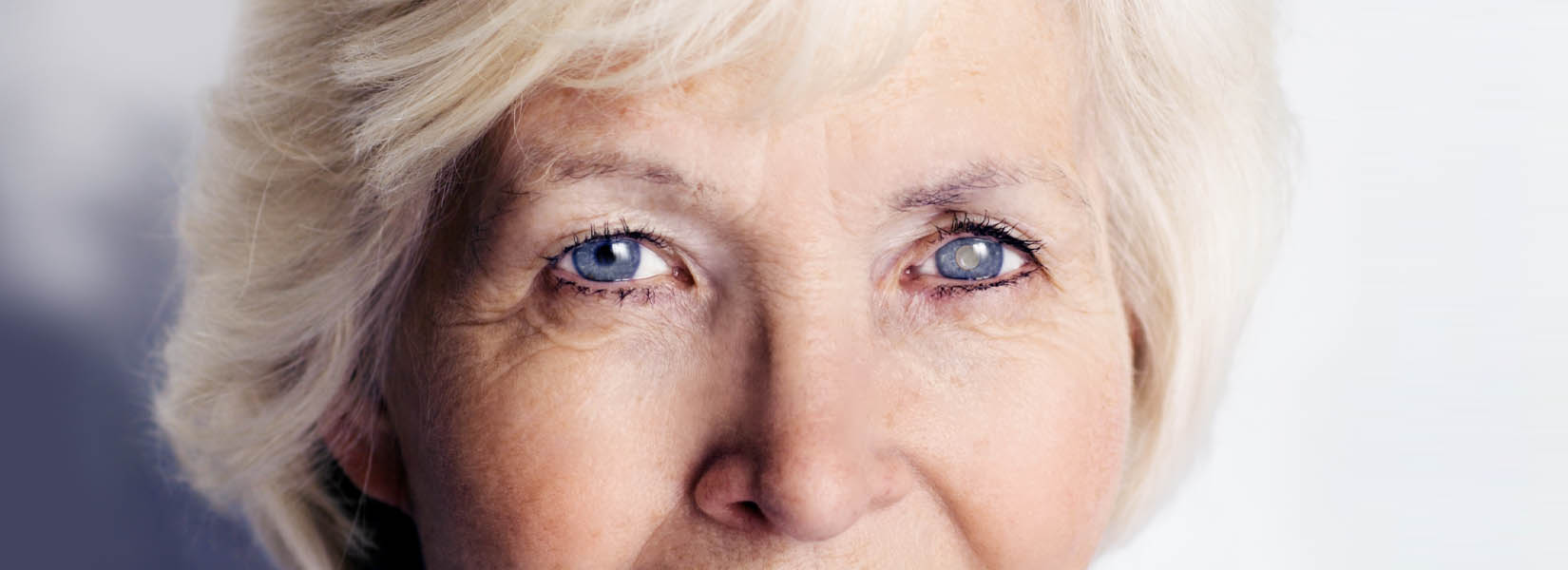 Cataract Surgery in The Uplands